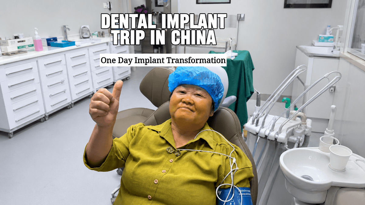 Full Mouth Dental Implants in China: Cost, Case & Reviews