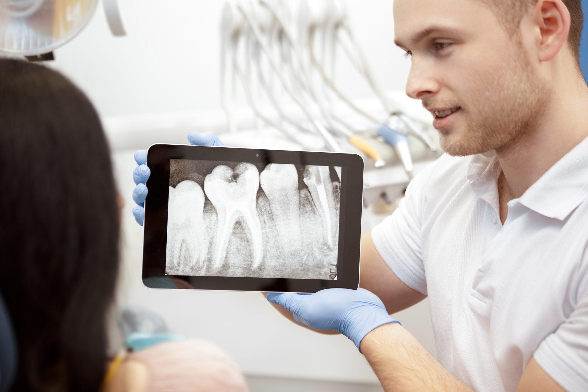 IMPLANTS FOR DIABETICS