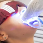best teeth whitening