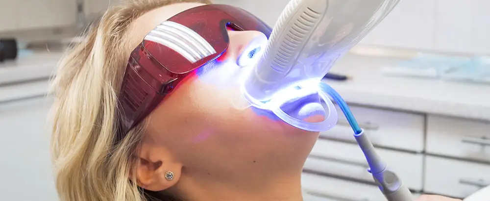 best teeth whitening