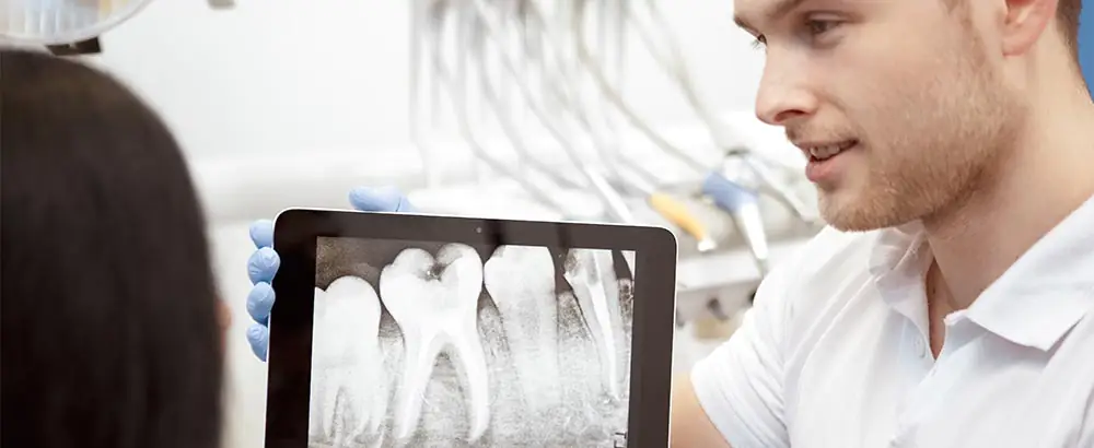 dental implants cost