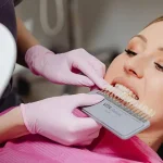 dental veneers cost