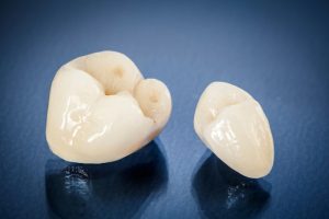 This may be costing you patients