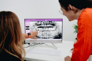 dental implants Spain
