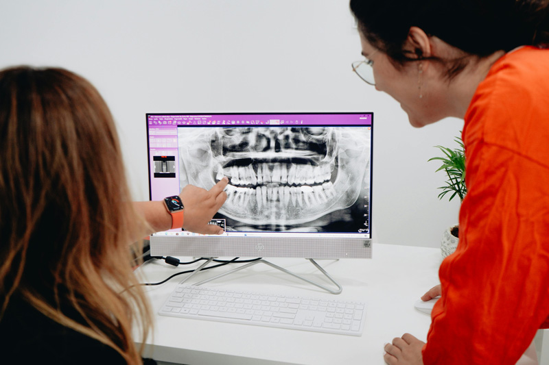 dental implants Spain