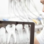 dental consultation near me