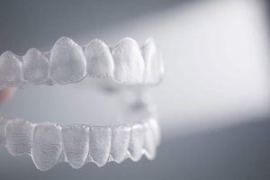 retainer