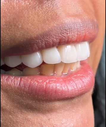 teeth