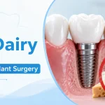 why no dairy after dental implant​​