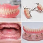 dentures