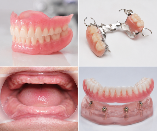 dentures