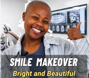 dental veneers in China
