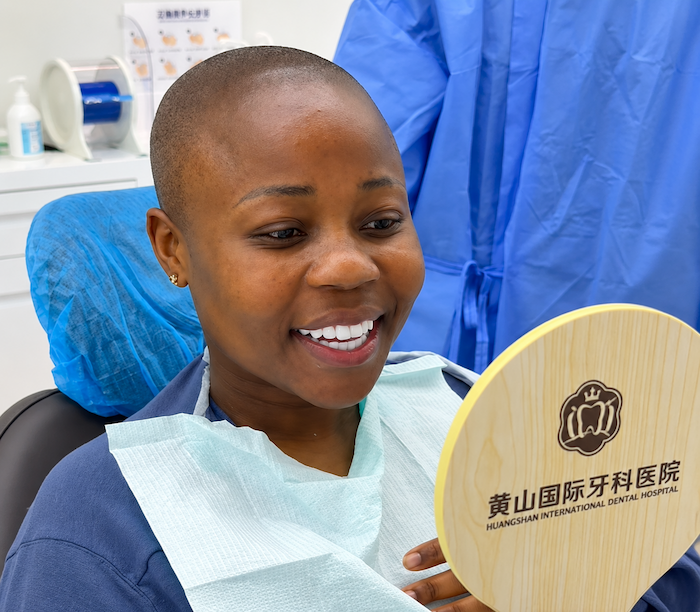 dental veneers in China