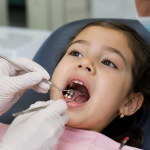 stainless steel crowns for kids