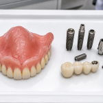 removable dentures vs dental implants