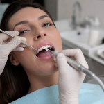 how to remove veneer