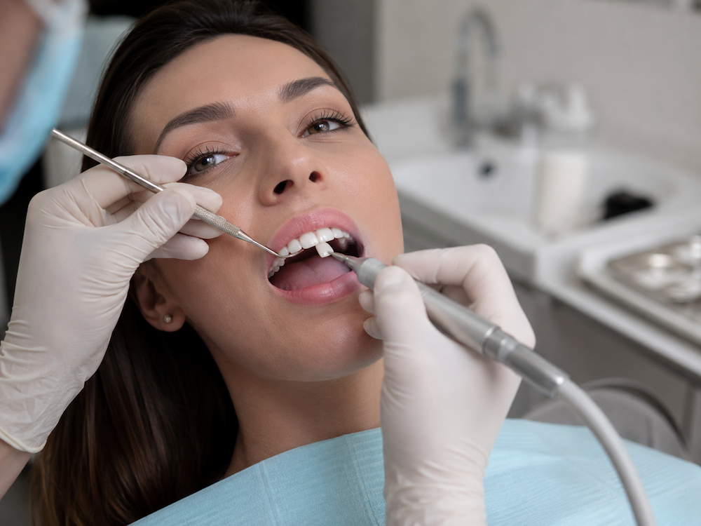 how to remove veneer
