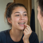 tooth movement during braces