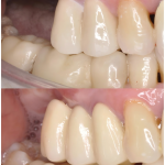 dental implants case