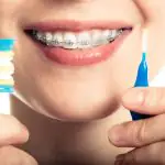 orthodontic