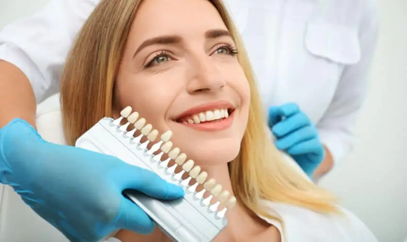 dental veneers