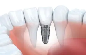 dental