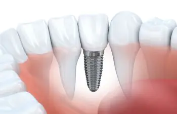dental
