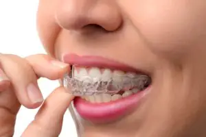 retainer teeth