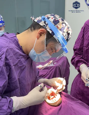 dental implants in China