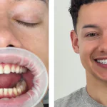 smile makeover in China