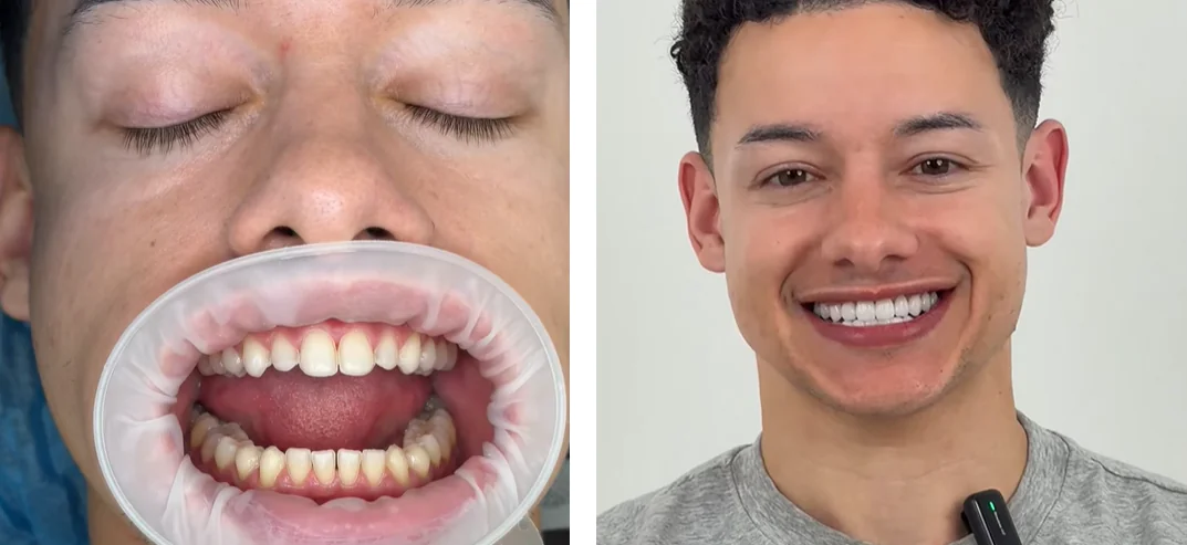 smile makeover in China