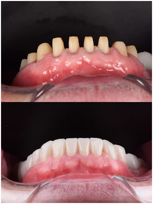 Jonathon Peter before and after result