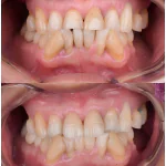 dental restoration in China