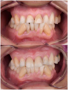 dental restoration in China