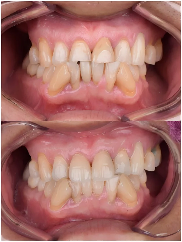 dental restoration in China