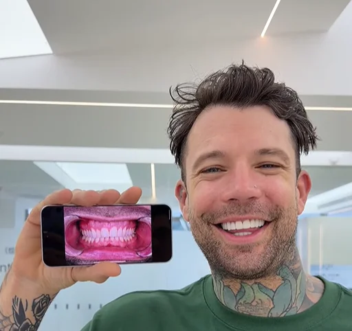 smile makeover in China